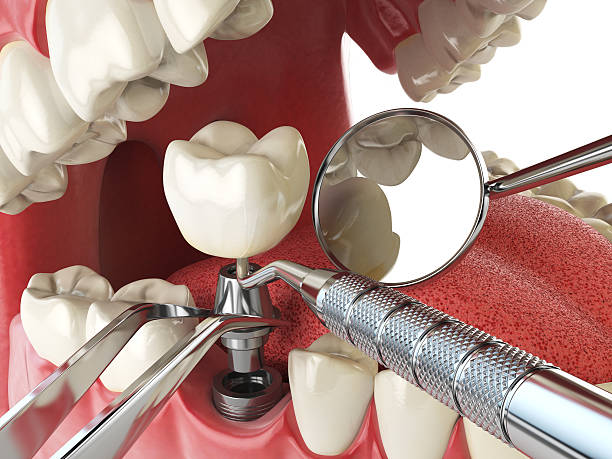 Best Emergency Dentist for Knocked-Out Tooth in Louisa, KY